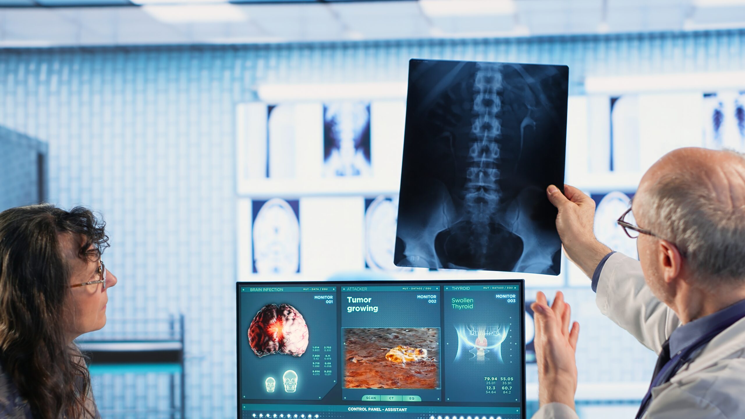 Oncology consultation takes place as a senior medic explains radiology scan