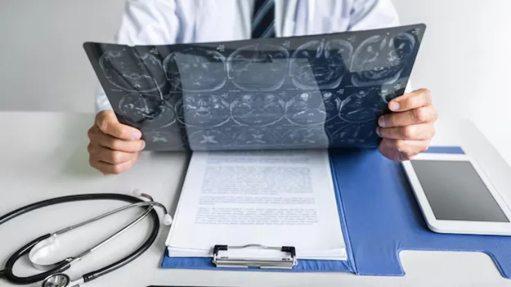 How Neurology Billing & Coding Services Improve Accuracy